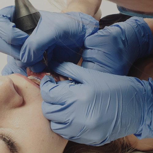 Przygotowanie do sesji | PROPAGANDA TATTOO & PIERCING | Studio tatuażu i piercingu Poznań. Tatuaże artystyczne, dobre studio, najlepsze studio w Poznaniu. Tatuaże realistyczne, realistyka, oldschool, cartoon, dotwork, sketch. Tatuaże portrety realistyczne, zwierzęta, kolorowe tatuaże.