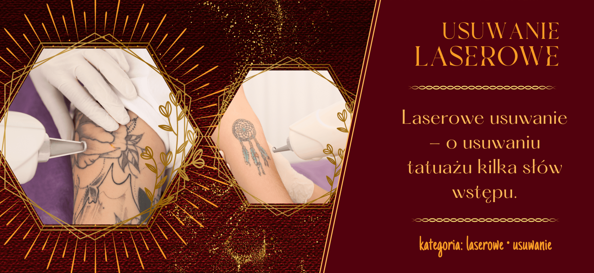 Laserowe usuwanie tatuażu - PROPAGANDA TATTOO & PIERCING | Studio tatuażu i piercingu Poznań. Tatuaże artystyczne, dobre studio, najlepsze studio w Poznaniu. Tatuaże realistyczne, realistyka, oldschool, cartoon, dotwork, sketch. Tatuaże portrety realistyczne, zwierzęta, kolorowe tatuaże.