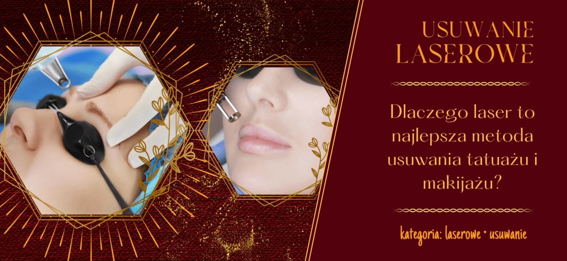 Dlaczego laser to najlepsza metoda usuwania tatuażu? Studio laserowego usuwania tatuażu Poznań. Laserowe usuwanie tatuażu poznań. Laserowe usuwanie makijażu permanentnego Poznań. Usuwanie brwi, ust, makijażu Poznań