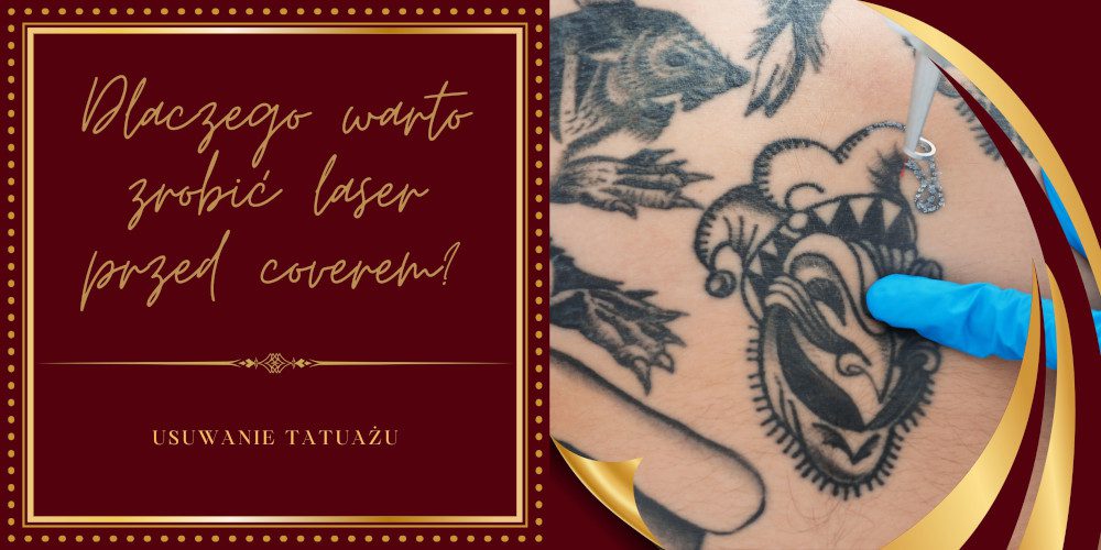 Dlaczego warto zrobić laser przed coverem albo odświeżeniem tatuażu? Studio laserowego usuwania tatuażu Poznań. Laserowe usuwanie tatuażu poznań. Laserowe usuwanie makijażu permanentnego Poznań. Usuwanie brwi, ust, makijażu Poznań