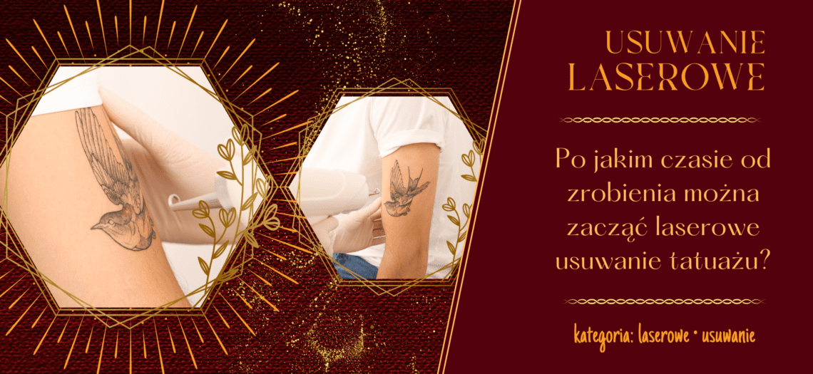 Kiedy i po jakim czasie można zacząć usuwać tatuaż? Studio laserowego usuwania tatuażu Poznań. Laserowe usuwanie tatuażu poznań. Laserowe usuwanie makijażu permanentnego Poznań. Usuwanie brwi, ust, makijażu Poznań